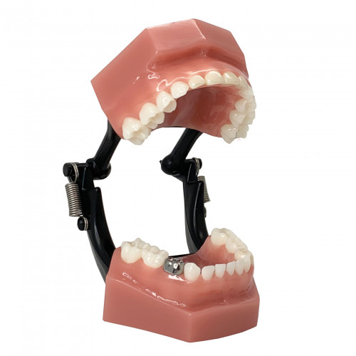 Consultation Model(덴티폼)